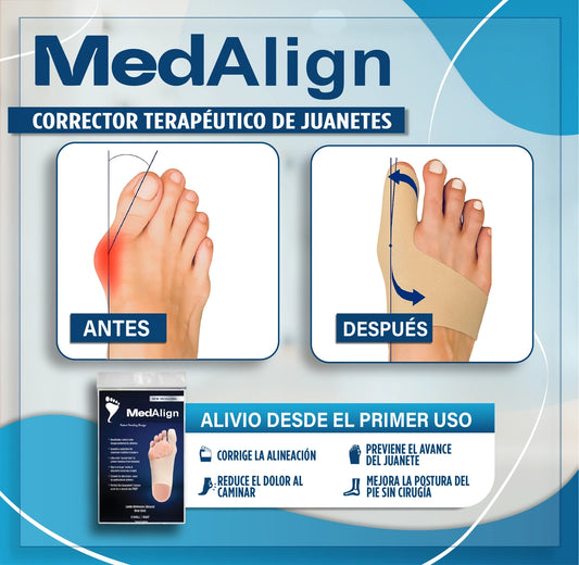 MedAlign™ | Corrector Terapéutico de Juanetes (Pack x 2)